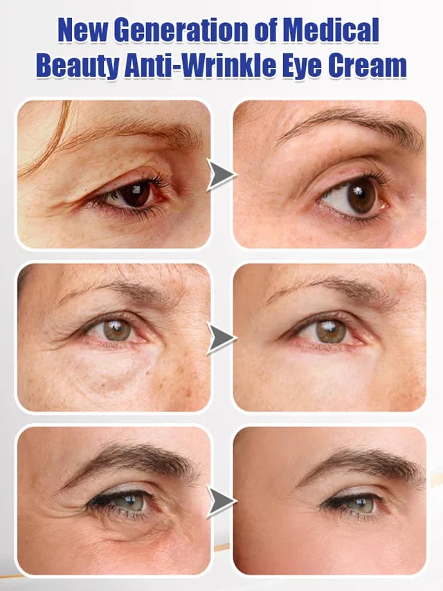 Firming and Moisturizing Eye Cream