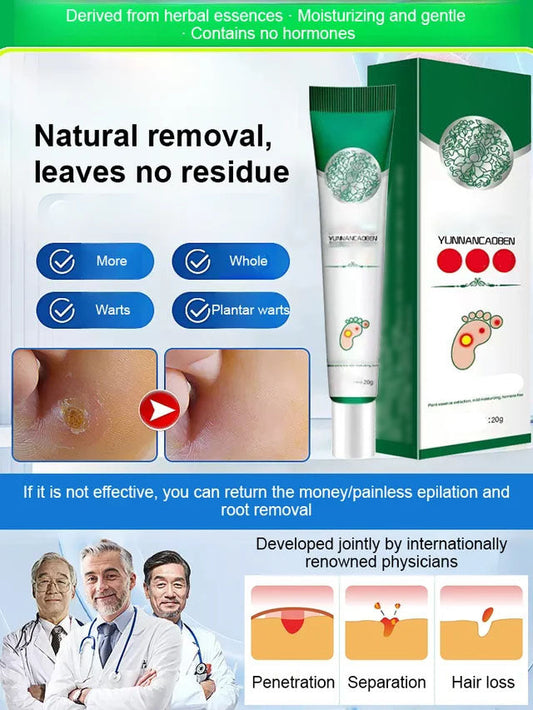 7 Days Pain-Free Herbal Cocoon Removal Cream
