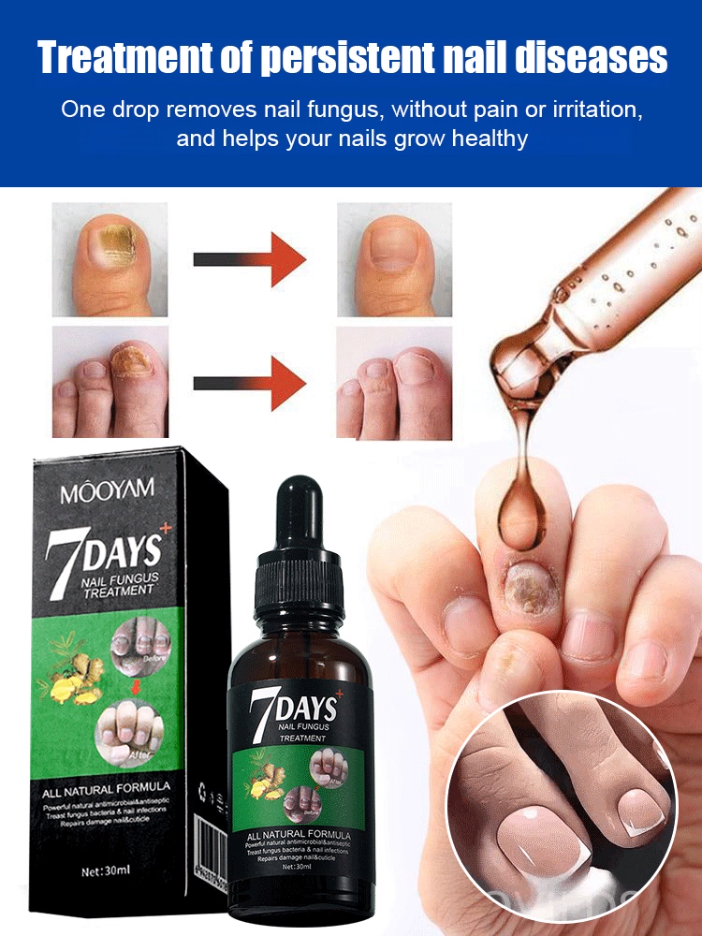 Ginger Nail Care Solution