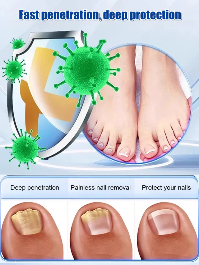 Ginger Nail Care Solution