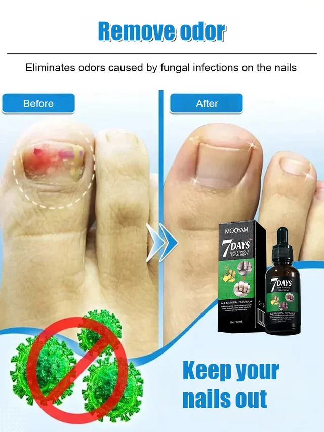 Ginger Nail Care Solution