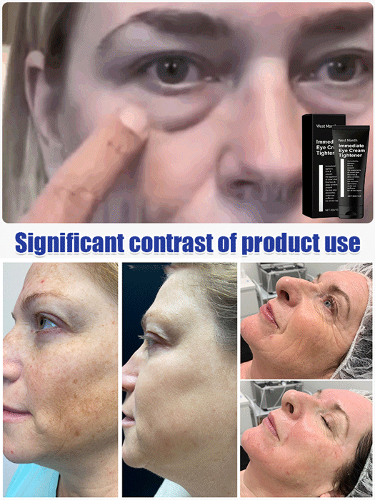 Firming and Moisturizing Eye Cream