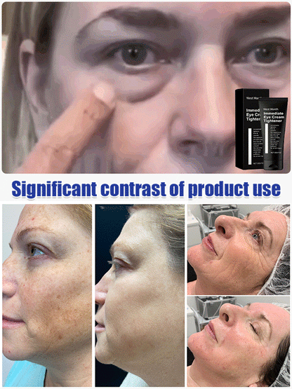 Firming and Moisturizing Eye Cream