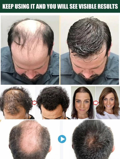 Hair Growth Essence Treatment Spray